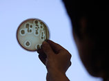      E. Coli ( )  ,   ,  47 ,       46 