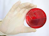   E.coli,            ,      ,    ,   
