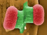  E.coli   ,  47      
