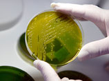       Escherichia coli ( ).  E.coli        
