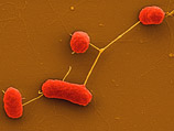       Escherichia coli ( )
