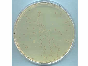  Escherichia coli   .    strubiol.icr.ac.uk