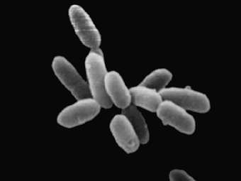     Halobacteria.  NASA